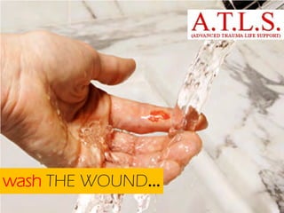 wash THE WOUND...

 