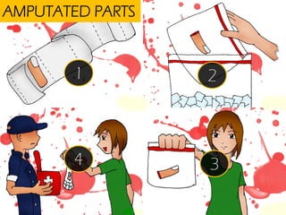 AMPUTATED PARTS

1

2

4

3

 