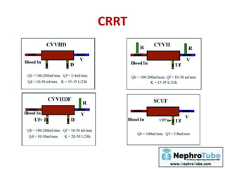 Physiological Principles of Hemodialysis - (An link for an update of ...