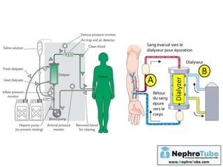 Physiological Principles of Hemodialysis - (An link for an update of ...