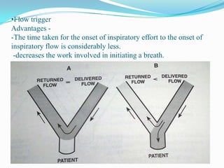 Principles of icu ventilators | PPTX