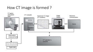 PRINCIPLES OF IMAGE RECONSTRUCTION IN CT - poonam rijal.pptx