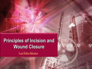 Principles of Incision and
Wound Closure
Fuad Ridha Mahabot

1

 