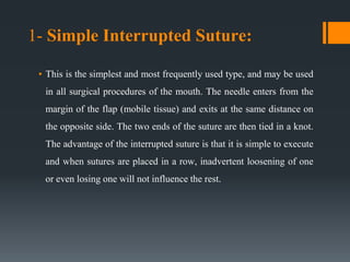 Principles of, incisions in oral surgery.ppt