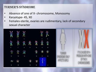 turner’s syndroMe
• Absence of one of X- chromosome, Monosomy
• Karyotype- 45, X0
• Females-sterile, ovaries are rudimentary, lack of secondary
sexual character
 