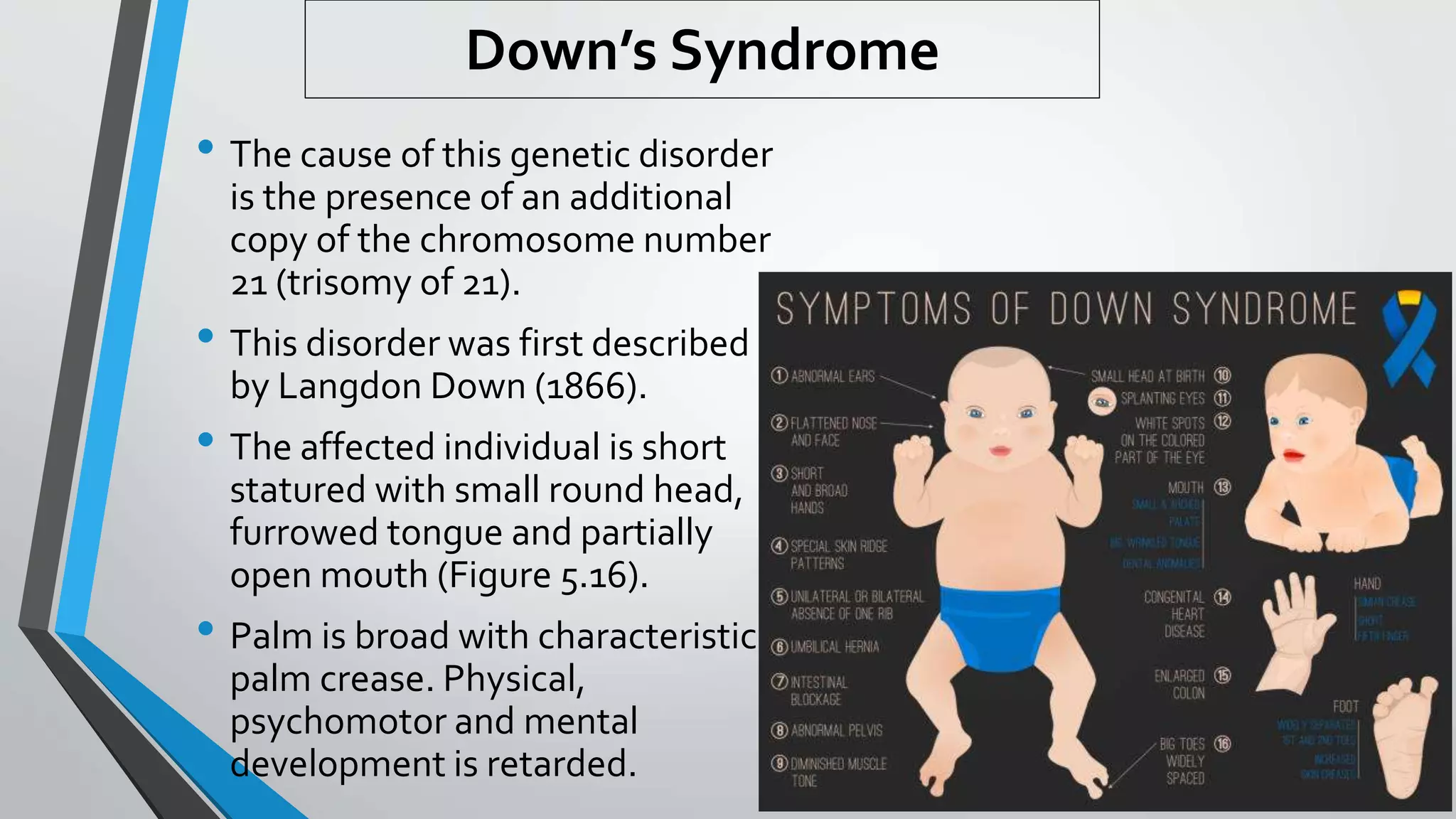 Down’s Syndrome
• The cause of this genetic disorder
is the presence of an additional
copy of the chromosome number
21 (trisomy of 21).
• This disorder was first described
by Langdon Down (1866).
• The affected individual is short
statured with small round head,
furrowed tongue and partially
open mouth (Figure 5.16).
• Palm is broad with characteristic
palm crease. Physical,
psychomotor and mental
development is retarded.
 