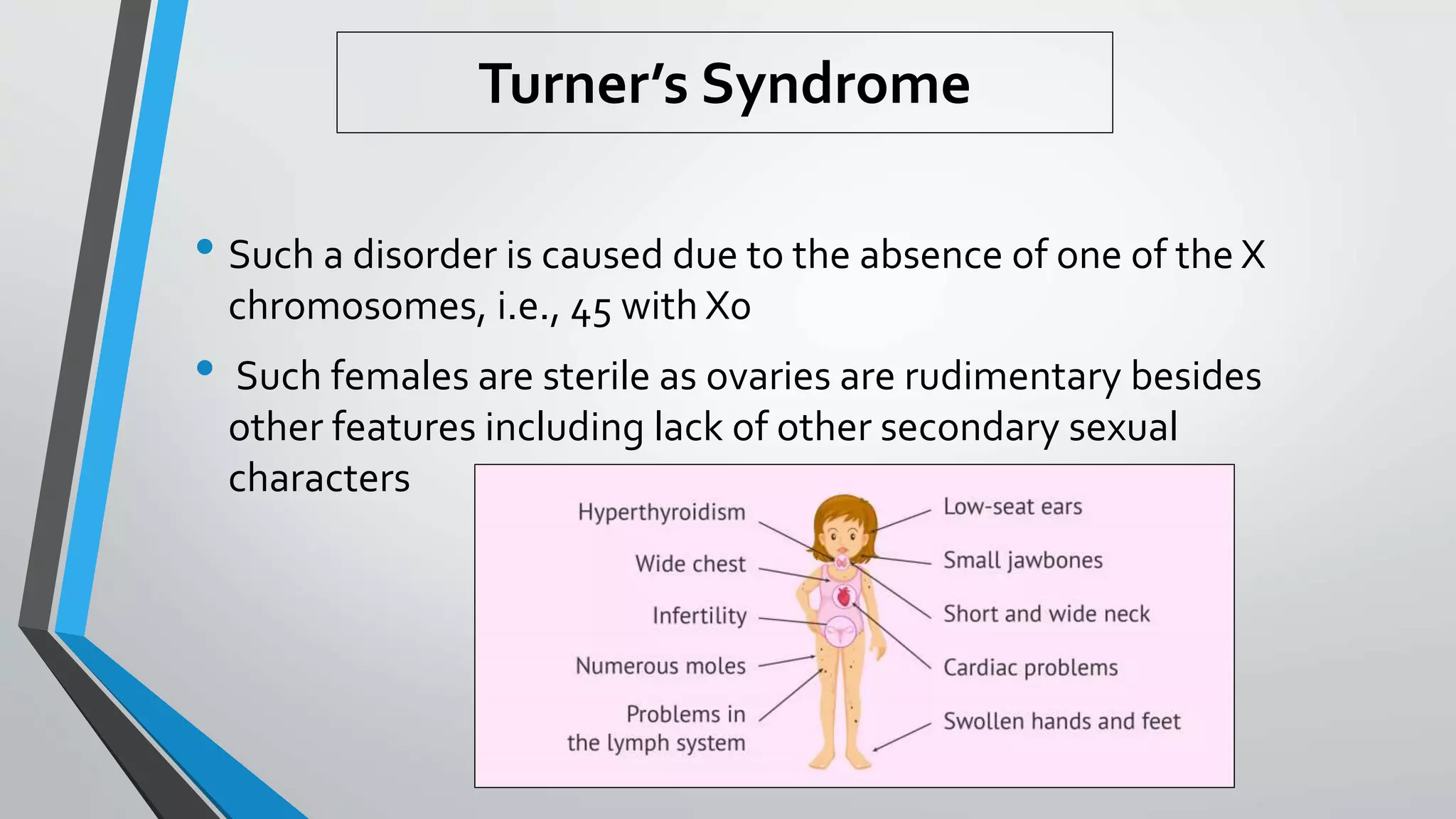 Turner’s Syndrome
• Such a disorder is caused due to the absence of one of the X
chromosomes, i.e., 45 with X0
• Such females are sterile as ovaries are rudimentary besides
other features including lack of other secondary sexual
characters
 