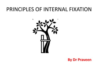 PRINCIPLES OF INTERNAL FIXATION
By Dr Praveen
 