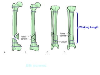 Blk screws.
Working Length
 