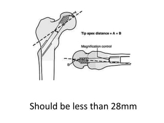 Should be less than 28mm
 