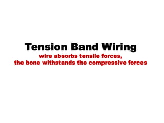 Tension Band Wiring
wire absorbs tensile forces,
the bone withstands the compressive forces
 