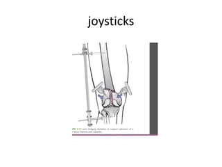 joysticks
 