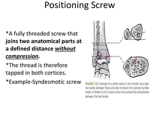 Positioning Screw
*A fully threaded screw that
joins two anatomical parts at
a defined distance without
compression.
*The thread is therefore
tapped in both cortices.
*Example-Syndesmotic screw
 