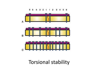 Torsional stability
 