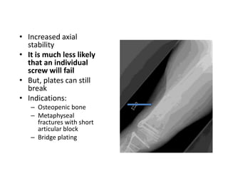 • Increased axial
stability
• It is much less likely
that an individual
screw will fail
• But, plates can still
break
• Indications:
– Osteopenic bone
– Metaphyseal
fractures with short
articular block
– Bridge plating
 