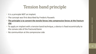 PRINCIPLES OF INTERNAL FIXATIONs(1).pptx
