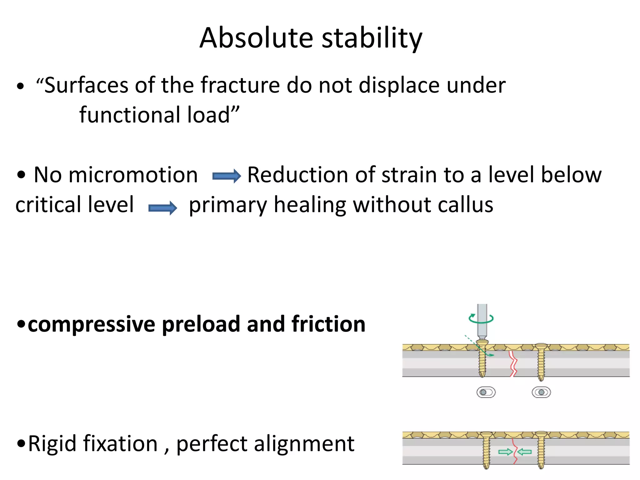 • “Surfaces of the fracture do not displace under
functional load”
• No micromotion Reduction of strain to a level below
critical level primary healing without callus
•compressive preload and friction
•Rigid fixation , perfect alignment
Absolute stability
 