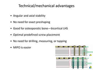 Technical/mechanical advantages
• Angular and axial stability
• No need for exact preshaping
• Good for osteoporotic bone—bicortical LHS
• Optimal predefined screw placement
• No need for drilling, measuring, or tapping
• MIPO is easier
 