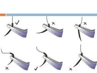 Microsurgery Sign Principles of Microsurgery | PPTX