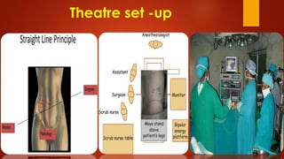 Principles of Minimal Invasive Surgery or Laparoscopic Surgery | PDF