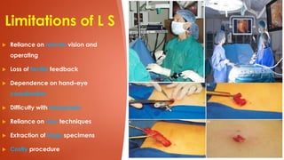 Principles of Minimal Invasive Surgery or Laparoscopic Surgery | PDF