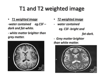 Principles of MRI | PPTX