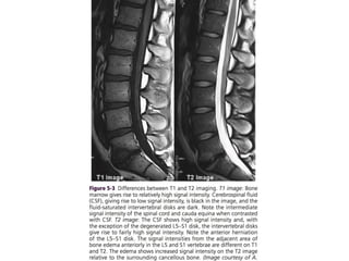 Principles of MRI | PPTX