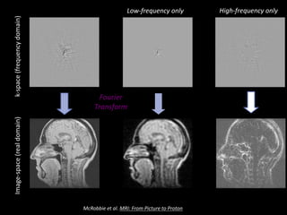 Figure 7.10 Images and their 2D spectra (k-space) showing: (a) reconstruction from all spatial frequencies, (b) low spatial
(a) (b) (c)
k-space	(frequency	domain)Image-space	(real	domain)
Fourier	
Transform
Low-frequency	only High-frequency	only
McRobbie et	al.	MRI:	From	Picture	to	Proton
 