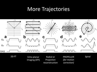 More	Trajectories
GX
DAQ
GY
a b
kx
ky
kx
ky
kx
ky
kx
ky
kx
ky
c d e
2D	FT Echo-planar	
Imaging	(EPI)
Radial	or	
Projection	
reconstruction
PROPELLER	
(for	motion	
correction)
Spiral
 