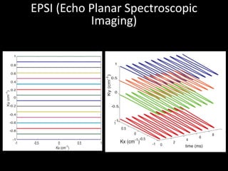0
2
4
6
8
10
-1
-0.5
0
0.5
1
-1
-0.5
0
0.5
1
Ky(cm-1
)
time (ms)
Kx (cm-1
)
EPSI	(Echo	Planar	Spectroscopic	
Imaging)
-1 -0.5 0 0.5 1
-1
-0.8
-0.6
-0.4
-0.2
0
0.2
0.4
0.6
0.8
1
Kx (cm-1
)
Ky(cm-1
)
 