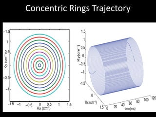Concentric	Rings	Trajectory
 