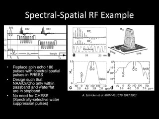 Spectral-Spatial	RF	Example
A.	Schricker et	al.	MRM	46:1079-1087	2001
• Replace spin echo 180
pulses with spectral spatial
pulses in PRESS
• Design such that
NAA/Cr/Cho only within
passband and water/fat
are in stopband
• No need for CHESS
(Spectrally-selective water
suppression pulses)
 