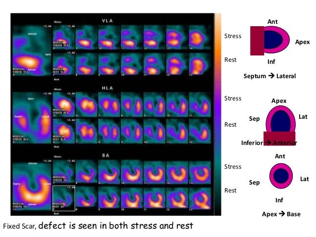 Principles Of Nuclear Cardiology