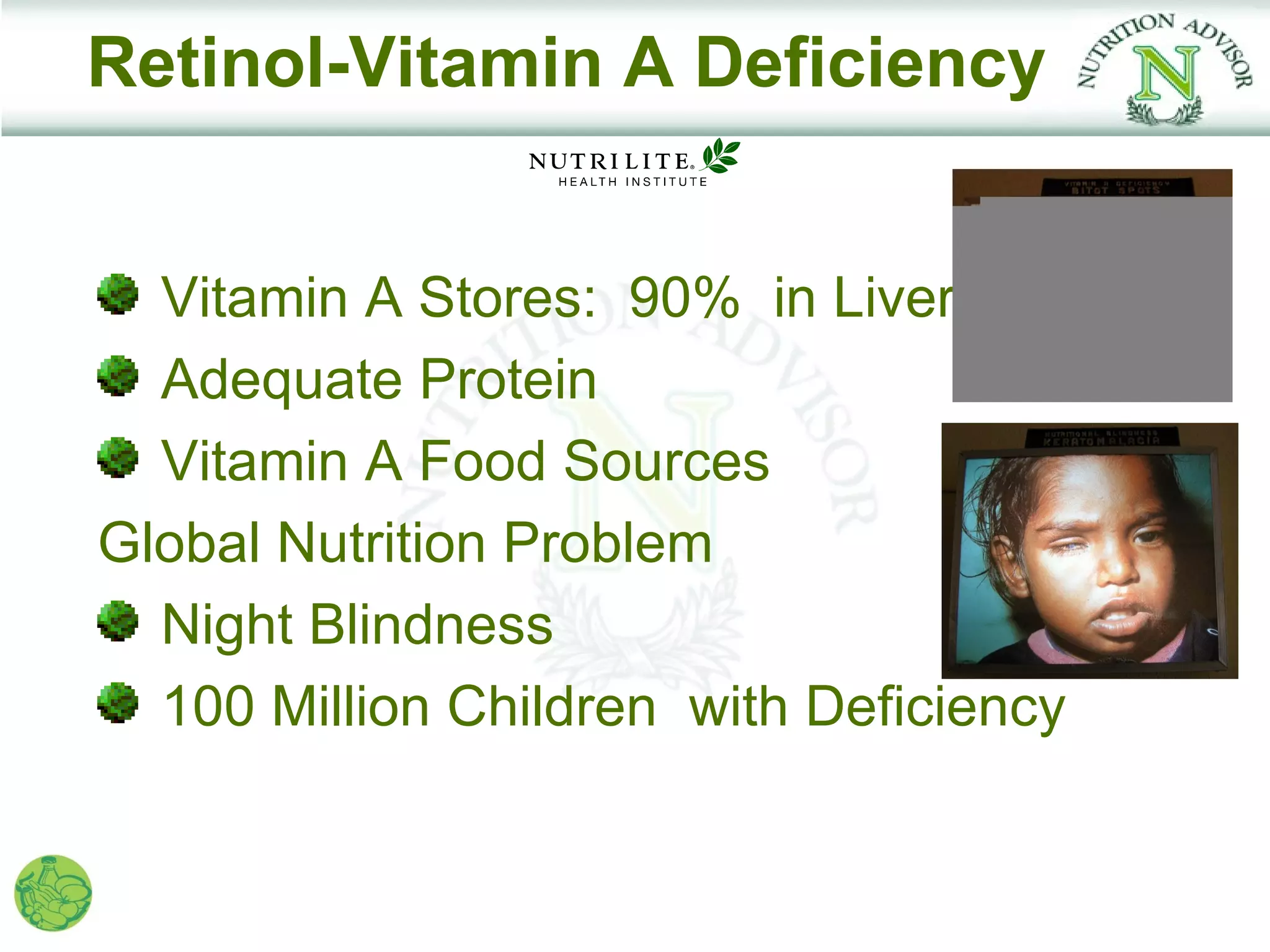 Retinol-Vitamin A Deficiency


  Vitamin A Stores: 90% in Liver
  Adequate Protein
  Vitamin A Food Sources
Global Nutrition Problem
  Night Blindness
  100 Million Children with Deficiency
 