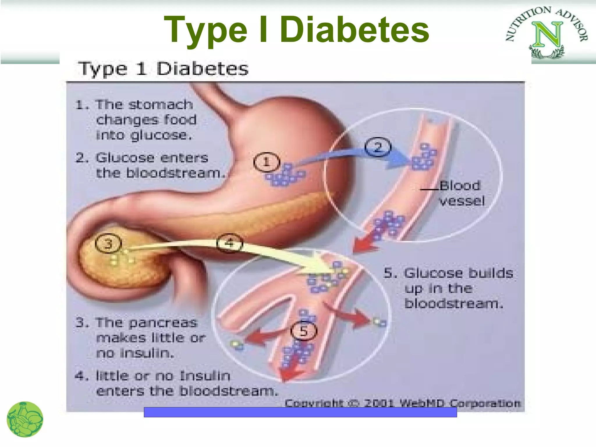 Type I Diabetes
 