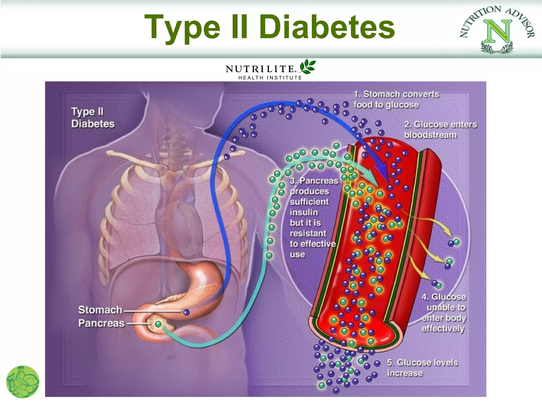 Type II Diabetes
 