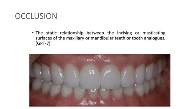 Principles of occlusion.pptx | Dental Health | Diseases and Conditions