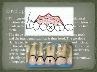 Principles of oral surgery | PPTX