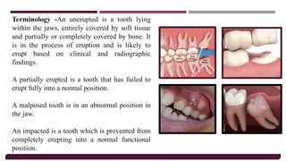 Principles Of Oral Surgery, Armamentarium &.pptx