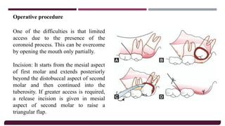 Principles Of Oral Surgery, Armamentarium &.pptx