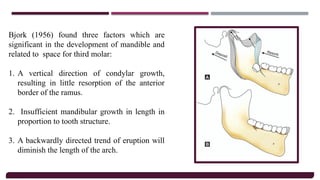 Principles Of Oral Surgery, Armamentarium &.pptx
