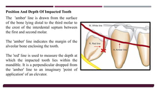 Principles Of Oral Surgery, Armamentarium &.pptx