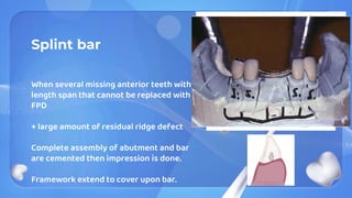 Splint bar
When several missing anterior teeth with
length span that cannot be replaced with
FPD
+ large amount of residual ridge defect
Complete assembly of abutment and bar
are cemented then impression is done.
Framework extend to cover upon bar.
 