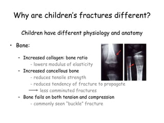 Why are children’s fractures different?
Children have different physiology and anatomy
• Bone:
– Increased collagen: bone ratio
- lowers modulus of elasticity
– Increased cancellous bone
- reduces tensile strength
- reduces tendency of fracture to propagate
less comminuted fractures
– Bone fails on both tension and compression
- commonly seen “buckle” fracture
 