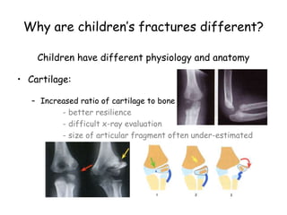 Why are children’s fractures different?
Children have different physiology and anatomy
• Cartilage:
– Increased ratio of cartilage to bone
- better resilience
- difficult x-ray evaluation
- size of articular fragment often under-estimated
 