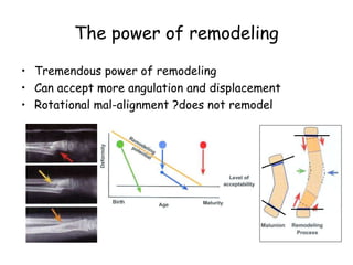 The power of remodeling
• Tremendous power of remodeling
• Can accept more angulation and displacement
• Rotational mal-alignment ?does not remodel
 