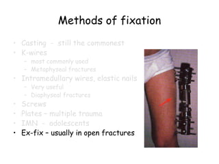 Methods of fixation
• Casting - still the commonest
• K-wires
– most commonly used
– Metaphyseal fractures
• Intramedullary wires, elastic nails
– Very useful
– Diaphyseal fractures
• Screws
• Plates – multiple trauma
• IMN - adolescents
• Ex-fix – usually in open fractures
 