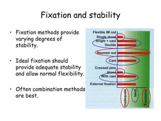 Fixation and stability
• Fixation methods provide
varying degrees of
stability.
• Ideal fixation should
provide adequate stability
and allow normal flexibility.
• Often combination methods
are best.
 