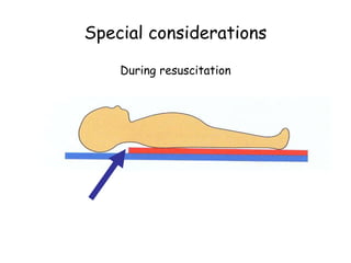 Special considerations
During resuscitation
 