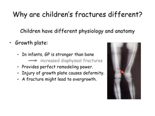 Why are children’s fractures different?
Children have different physiology and anatomy
• Growth plate:
– In infants, GP is stronger than bone
increased diaphyseal fractures
– Provides perfect remodeling power.
– Injury of growth plate causes deformity.
– A fracture might lead to overgrowth.
 
